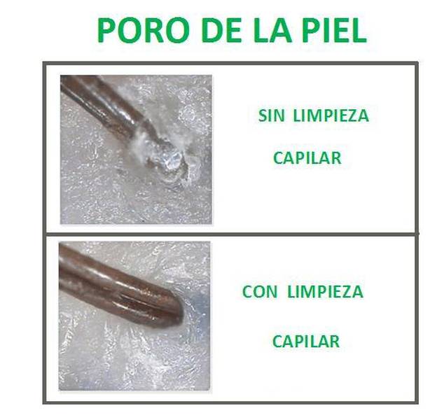 ¿Porqué son tan importantes las limpiezas capilares?